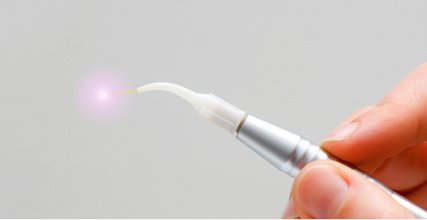 laser dentistry tool at Fort Bend Periodontics and Implantology